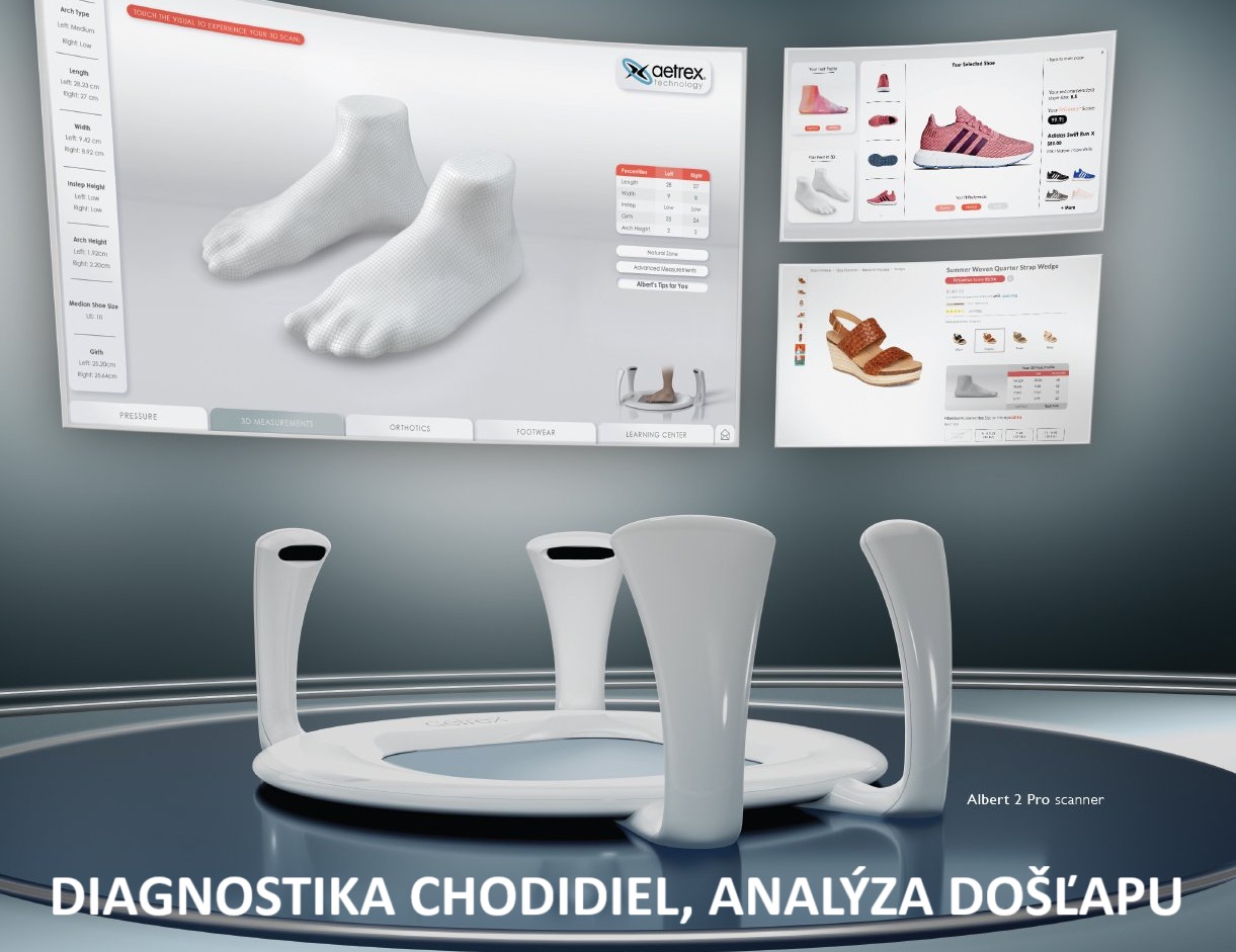 Pocitacova analyza chodidiel